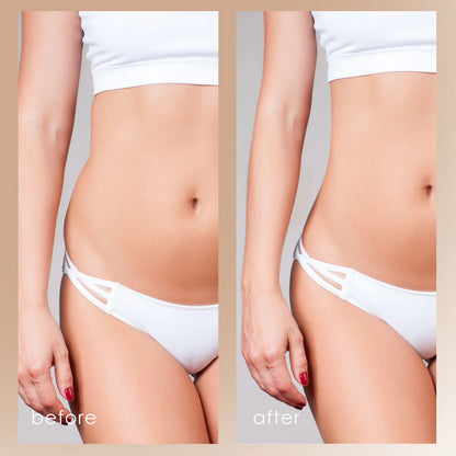 Slimming Gel